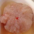 taiyou3's cooksnap of when they made 離乳食にも！蓮根饅頭.