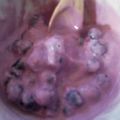 ﾘﾗｯｸﾏﾝ's cooksnap of when they made ブルーベリーのヨーグルトアイス.