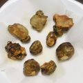 mashstar's cooksnap of when they made キクイモの素揚げ.