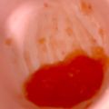 がんこママ♪'s cooksnap of when they made 初めてのトマト　～離乳食 第⑫弾～.