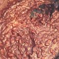 クック1SAA85☆'s cooksnap of when they made 【圧力鍋で】小豆の炊き方！.
