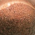 pukukoko's cooksnap of when they made 簡単３時間で！あんこの作り方（つぶあん）.