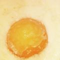 オクガ☆'s cooksnap of when they made 給食シリーズ★なんちゃって目玉焼き.
