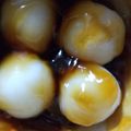 chihiroman's cooksnap of when they made レンチンタレのみたらし団子(少量).
