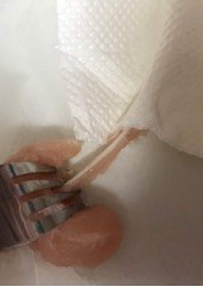 ちょー簡単！フォークでささみの筋取り！-レシピのメイン写真