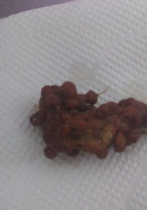 納豆好きにはたまらない!?納豆天ぷら-レシピのメイン写真