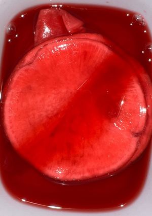 赤かぶの甘酢漬け-レシピのメイン写真