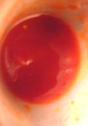 甘酢トマトのタレ-レシピのメイン写真