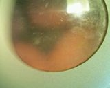卵小麦アレルギーのためのハンバーグ作り方7写真