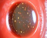 鶏肉とキャベツ入り中華蒸し麺鍋作り方6写真