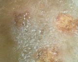かわいくておいしい★えびフライスコロッケ作り方11写真