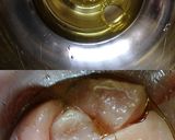 甘辛美味★鶏ささみのベーコン巻き作り方4写真