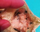 簡単！ほっこり美味＊油揚げのきんちゃく煮作り方12写真