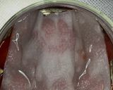 トマトの甘酢　　時短簡単入れるだけ作り方5写真