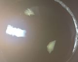 魚卵！！カレイの卵の煮付け作り方4写真