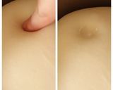 簡単おから入りカレーパン（ＨＢ使用）作り方5写真