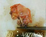 赤貝の剥き方作り方11写真