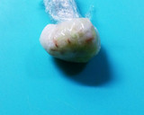 離乳食　噛み切りやすい＊３種のおにぎり＊作り方10写真