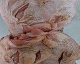鶏肉ステーキのオニオンソース添え作り方1写真
