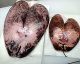 いろんなたらこ 真鱈の子で 4種のたらこ作り方2写真