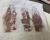 イワシの青しそ天ぷら　開き方作り方9写真