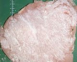 超減塩 チキンステーキ（鶏むね肉）作り方4写真