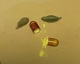 グルメ界に一石を投じたキウイの玉ねぎ炒め作り方3写真