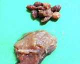 らっきょう塩昆布作り方4写真