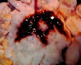鶏むね肉のおろし煮作り方3写真