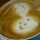 ミプリン